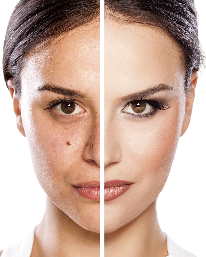 photorajeunissement-clinique-soins-corps